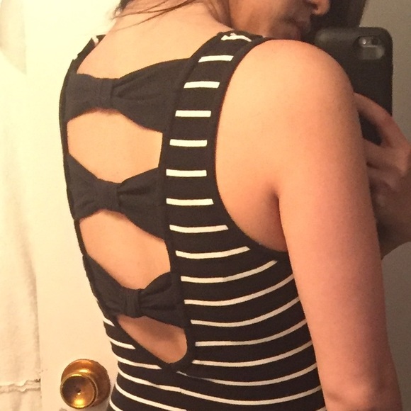 Forever 21 stripe dress with back detail - Picture 3 of 3